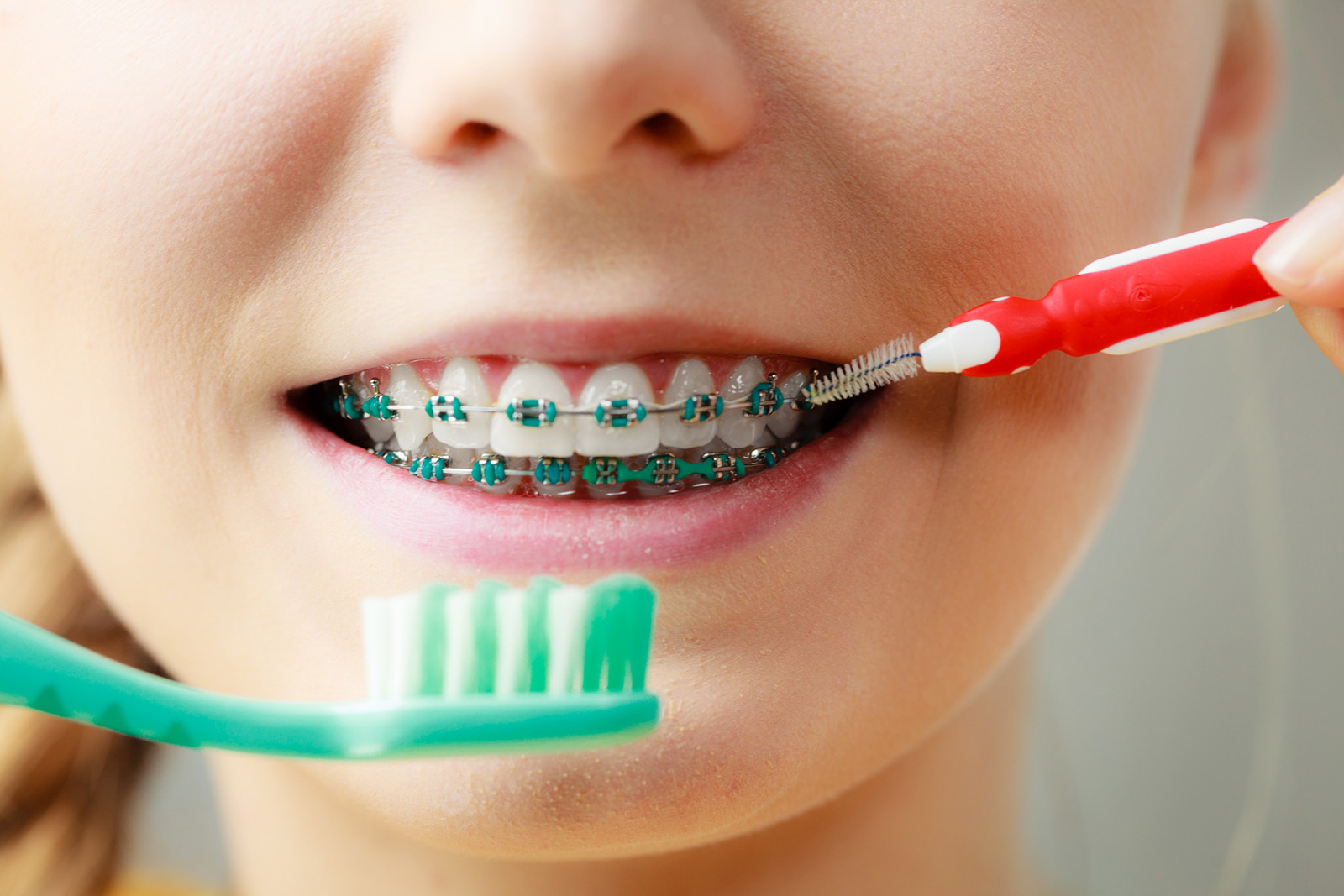 brush teeth orthodontist