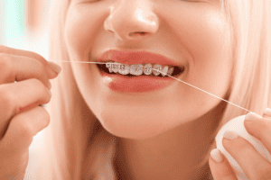 Woman with braces flossing her teeth