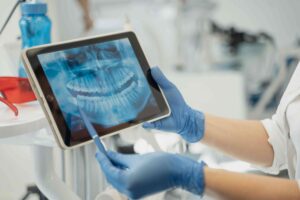 3d imaging of teeth